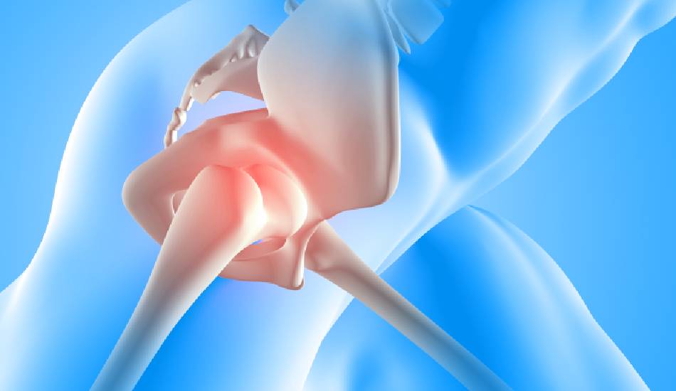 Joint/Bone Health consultation and support